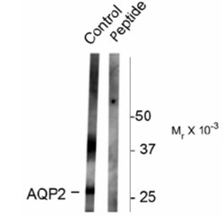 Aquaporin-2, p Ser261 Antibody, Novus Biologicals 0.1mL; Unlabeled:Antibodies,