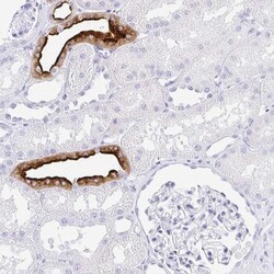 Aquaporin-2 Antibody, Novus Biologicals 0.1mL; Unlabeled:Antibodies, Polyclonal