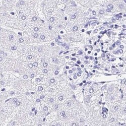 Aquaporin-2 Antibody, Novus Biologicals 0.1mL; Unlabeled:Antibodies, Polyclonal