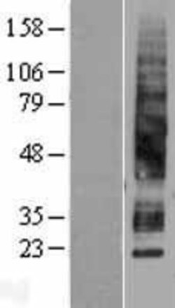Novus Biologicals&trade;&nbsp;Aquaporin-3 Overexpression Lysate