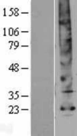 Novus Biologicals&trade;&nbsp;Aquaporin-5 Overexpression Lysate