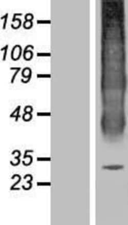 Novus Biologicals™ Aquaporin-6 Overexpression Lysate