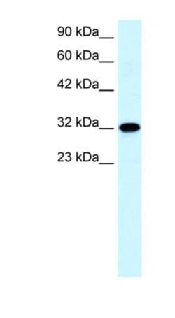 Aquaporin-7 Antibody, Novus Biologicals:Antibodies:Primary Antibodies