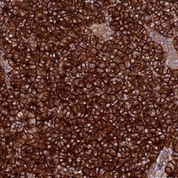Aquaporin-8 Antibody, Novus Biologicals 25 &mu;L; Unlabeled:Antibodies,