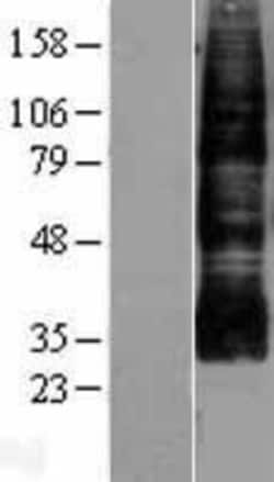 Novus Biologicals&trade;&nbsp;Aquaporin-9 Overexpression Lysate
