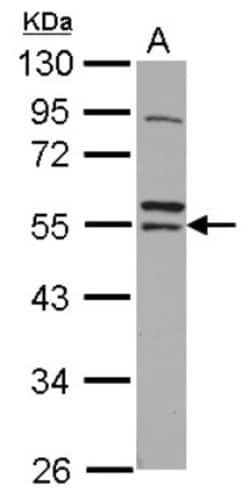 ARA54 Antibody, Novus Biologicals 0.1mL; Unlabeled:Antibodies, Polyclonal