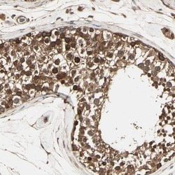 ARA54 Antibody, Novus Biologicals 0.1mL; Unlabeled:Antibodies, Polyclonal
