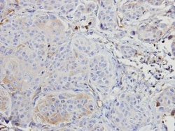 A-RAF Antibody, Novus Biologicals 0.1mL; Unlabeled:Antibodies, Polyclonal