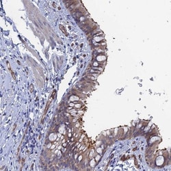 ARAP3 Antibody, Novus Biologicals:Antibodies:Primary Antibodies