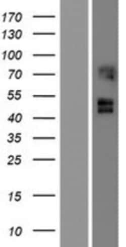 Novus Biologicals™ ARC/ARG3.1 Overexpression Lysate