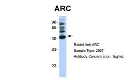 ARC/ARG3.1 Antibody, Novus Biologicals 0.05mg; Unlabeled:Antibodies, Polyclonal