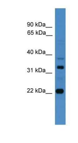 Archaemetzincin 2 Antibody, Novus Biologicals 100&mu;L; Unlabeled:Antibodies,