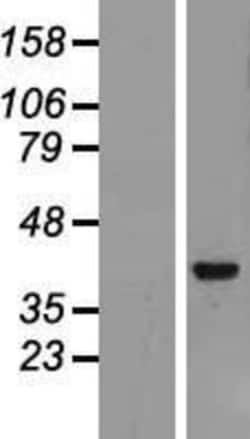 Novus Biologicals&trade;&nbsp;Archaemetzincin 2 Overexpression Lysate