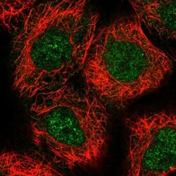 Archaemetzincin 2 Antibody, Novus Biologicals:Antibodies:Primary Antibodies