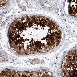 Archaemetzincin 2 Antibody, Novus Biologicals:Antibodies:Primary Antibodies