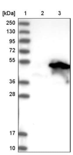 Archaemetzincin 2 Antibody, Novus Biologicals:Antibodies:Primary Antibodies