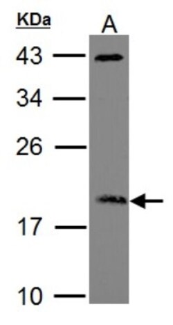 ARF3 Antibody, Novus Biologicals 100 &mu;L | Buy Online | Novus Biologicals | Fisher Scientific