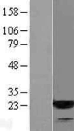 Novus Biologicals&trade;&nbsp;ARF3 Overexpression Lysate