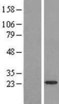 Novus Biologicals™ ARF4L Overexpression Lysate