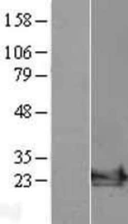 Novus Biologicals ARF6 Overexpression Lysate 0.1mg | Buy Online | Novus Biologicals&trade; | Fisher Scientific