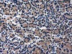 ARFGAP1 Antibody (OTI1F6), Novus Biologicals 0.1 mL | Buy Online | Novus Biologicals | Fisher Scientific