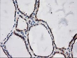 ARFGAP1 Antibody (OTI1F6), Novus Biologicals 0.1 mL | Buy Online | Novus Biologicals | Fisher Scientific