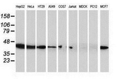 ARFGAP1 Antibody (OTI1F6), Novus Biologicals 0.1 mL | Buy Online | Novus Biologicals | Fisher Scientific
