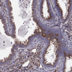 ARFGAP1 Antibody, Novus Biologicals:Antibodies:Primary Antibodies