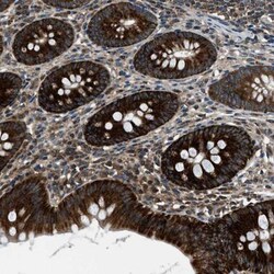 ARFGAP2 Antibody, Novus Biologicals:Antibodies:Primary Antibodies