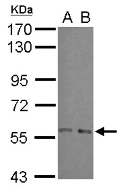ARFGAP3 Antibody, Novus Biologicals 0.1mL; Unlabeled:Antibodies, Polyclonal