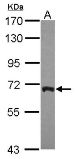 ARFGAP3 Antibody, Novus Biologicals 0.1mL; Unlabeled:Antibodies, Polyclonal