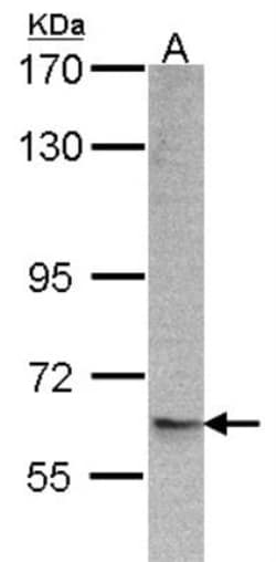 ARFGAP3 Antibody, Novus Biologicals 0.1 mL | Buy Online | Novus Biologicals | Fisher Scientific
