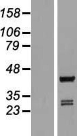 Novus Biologicals™ ARFIP1 Overexpression Lysate