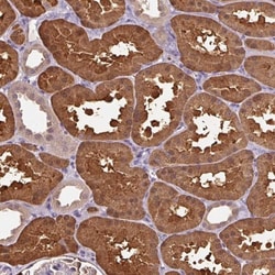 ARFIP1 Antibody, Novus Biologicals:Antibodies:Primary Antibodies