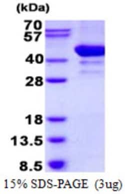Novus Biologicals&trade;&nbsp;Recombinant Human ARFIP2 His Protein