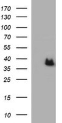 ARG2 Antibody (OTI3G5), Novus Biologicals 0.1mL; Unlabeled:Antibodies,