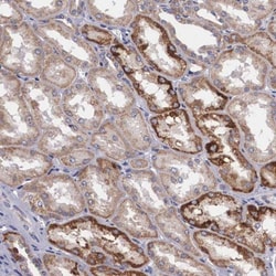 HSD17B4 Antibody, Novus Biologicals:Antibodies:Primary Antibodies