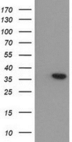 Arginase 1/ARG1/liver Arginase Antibody (OTI4E6), Novus Biologicals 0.1mL;