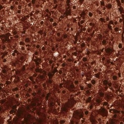 Arginase 1/ARG1/liver Arginase Antibody (CL0186), Novus Biologicals 25