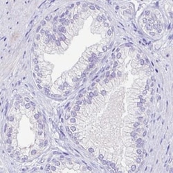 Arginase 1/ARG1/liver Arginase Antibody (CL0186), Novus Biologicals 25