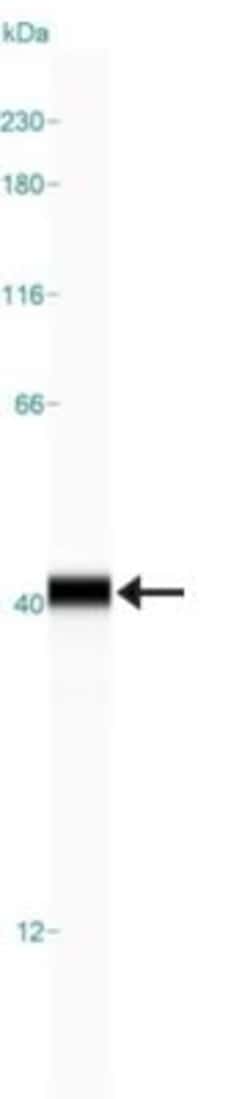 Arginase 1/ARG1/liver Arginase Antibody (CL0186), Novus Biologicals 25