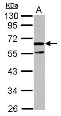 Arginine decarboxylase Antibody, Novus Biologicals 0.1mL; Unlabeled:Antibodies,
