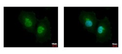 Argininosuccinate Lyase Antibody, Novus Biologicals 0.1mg; Unlabeled:Antibodies,