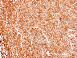 Argininosuccinate Lyase Antibody, Novus Biologicals 0.1mg; Unlabeled:Antibodies,
