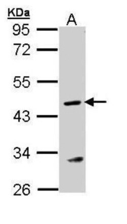 Argininosuccinate Lyase Antibody, Novus Biologicals 0.1mg; Unlabeled:Antibodies,
