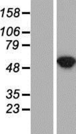 Novus Biologicals&trade;&nbsp;Argininosuccinate Lyase Overexpression Lysate