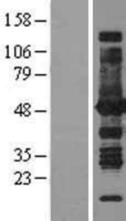 Novus Biologicals™ Argininosuccinate Synthase Overexpression Lysate