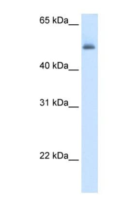 Argininosuccinate Lyase Antibody, Novus Biologicals:Antibodies:Primary