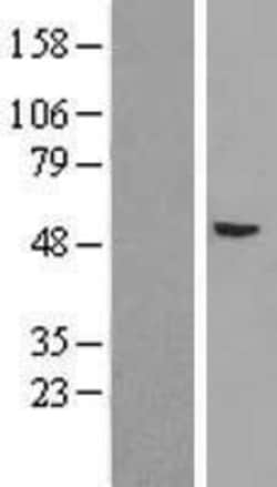 Novus Biologicals&trade;&nbsp;Argonaute 4 Overexpression Lysate