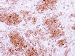 ARH Antibody, Novus Biologicals 0.1mL; Unlabeled:Antibodies, Polyclonal